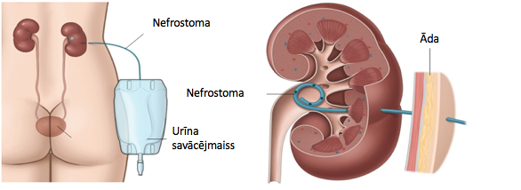 Nefrostoma